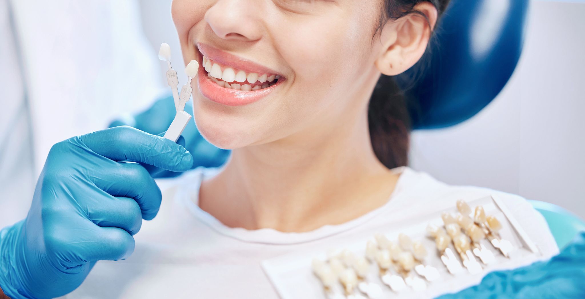 Composite veneers, Dental composite veneers, Composite veneers before and after, Affordable veneers option, Composite bonding veneers, Composite veneers vs porcelain, Cosmetic dental veneers, Composite veneers for smile makeover, Veneers for chipped teeth, Composite veneers for gaps, Tooth-colored veneers, Non-invasive veneers, Benefits of composite veneers, Composite veneers treatment, Composite veneers cost